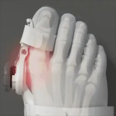 Optivivia ReAlign Pro